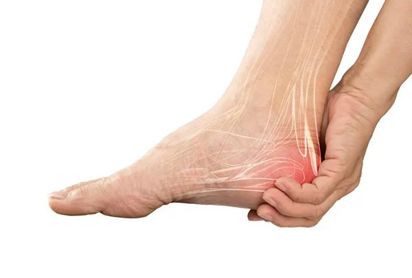 Neuropathy