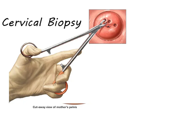 Surgical